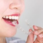 WHY YOU SHOULD CHOOSE INVISALIGN
