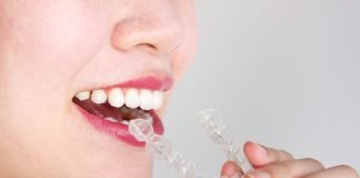 WHY YOU SHOULD CHOOSE INVISALIGN