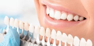 4 Factors You Ought To Consider Dental Veneers