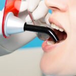 Mouth Ulcers and Canker Sores dental specialist