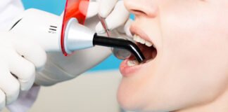 Mouth Ulcers and Canker Sores dental specialist