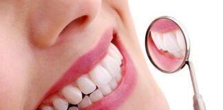 Teeth Bleaching in the Woodlands woodlands dentist