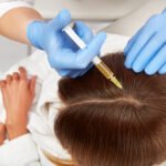 Hair Loss and Other Catastrophes – An Overview of Appropriate Hair Care hair prp sydney