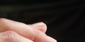 Examining The Need for Wisdom Tooth Concerns