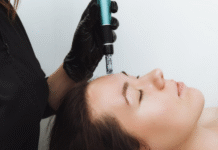 Discover How Morpheus8 Treatment Can Help in The Queensway, Etobicoke